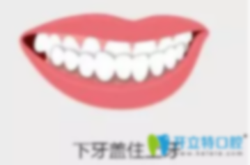 30岁牙齿地包天可以矫正吗