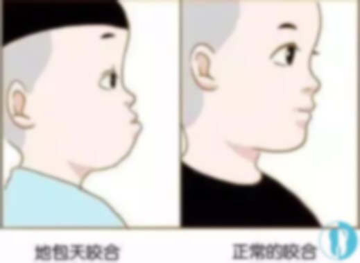 三十几岁地包天还龅牙可以矫正吗