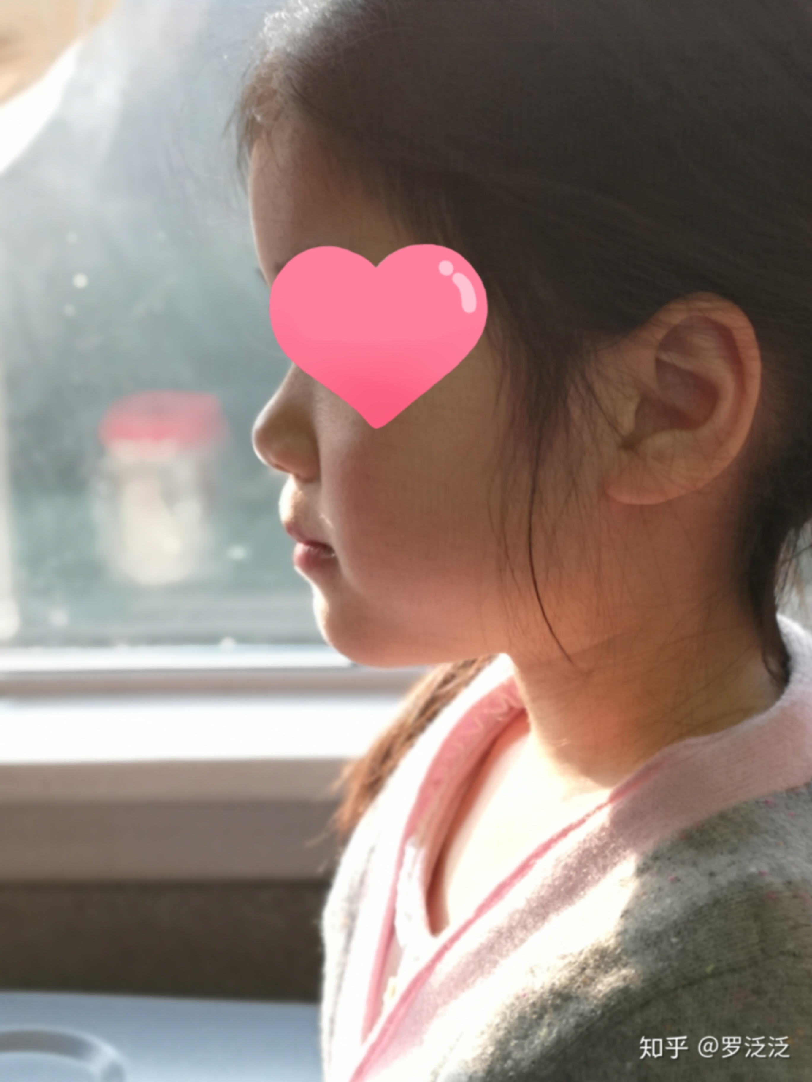 四岁女孩地包天怎么办